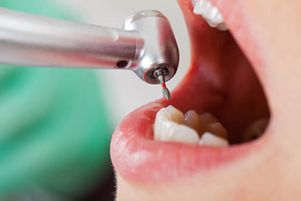 Best Emergency Denture Repair in Pink, OK